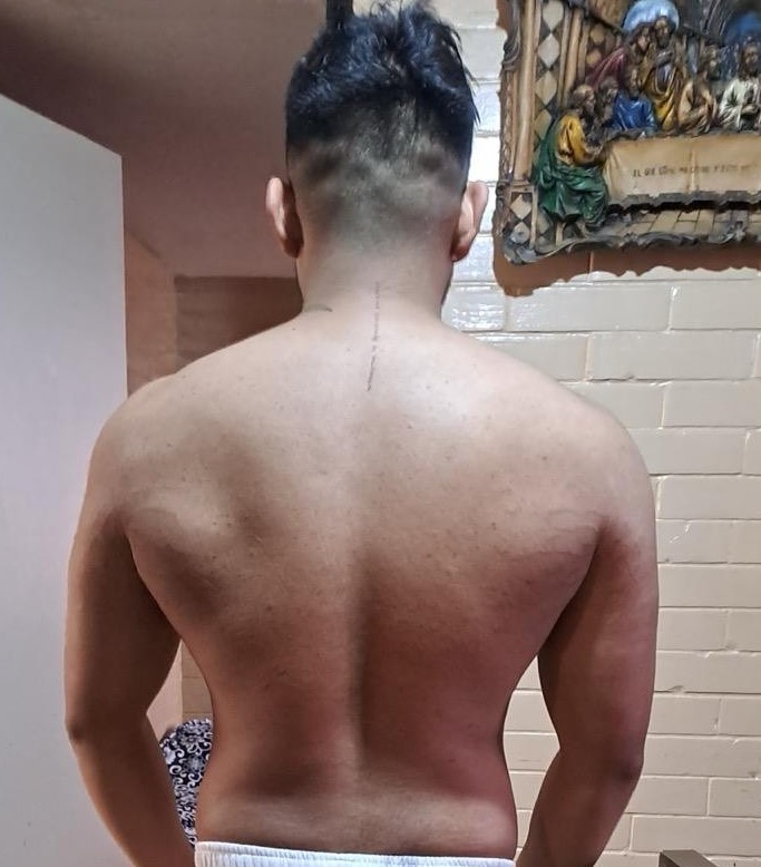 Antes